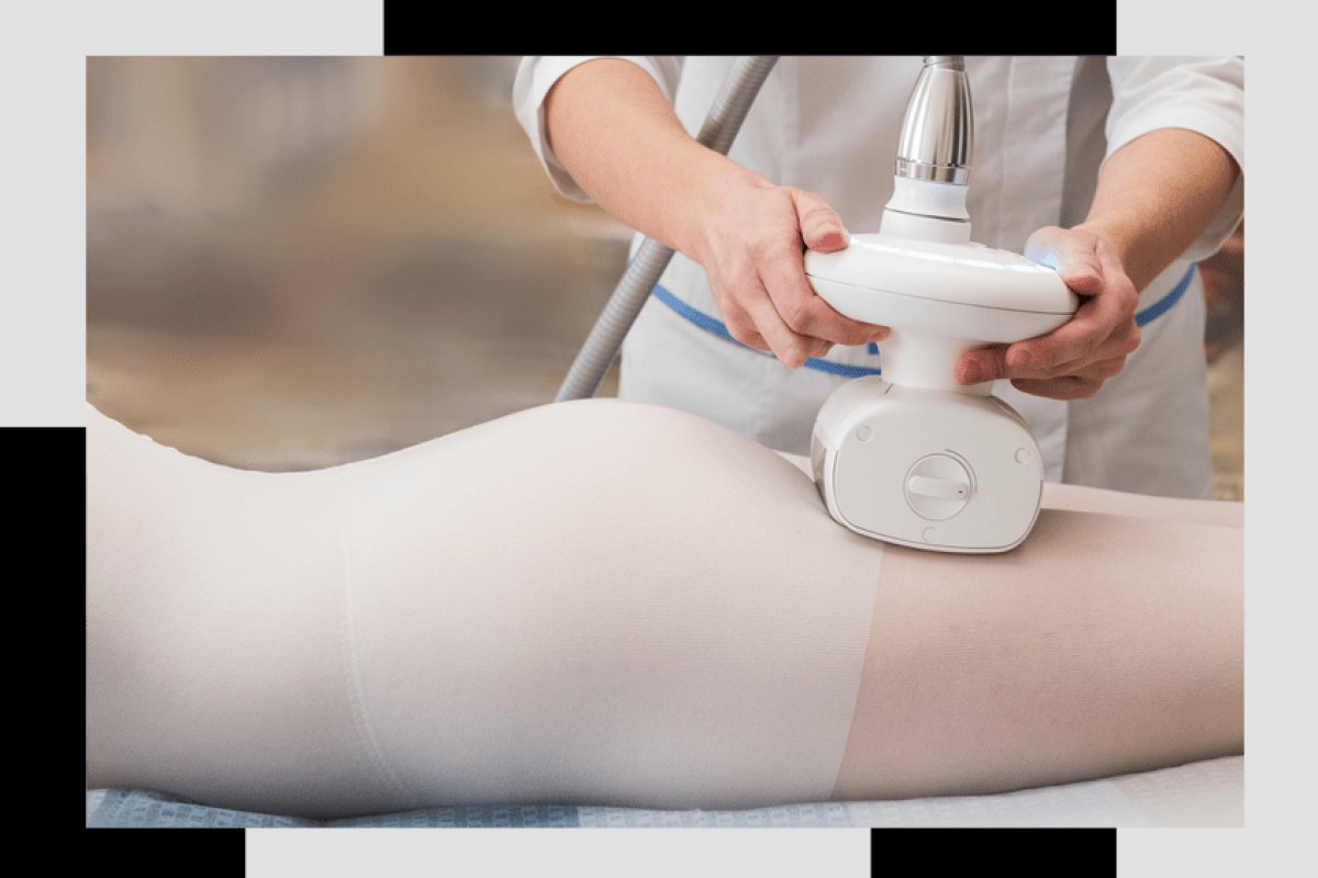 LPG Massage - Effektiv gegen Cellulite